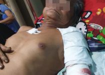 Diduga 13 Pelaku Penganiayaan Iskandar Alias Ambo Sita Masih Berkeliaran ,Ada Apa. ??